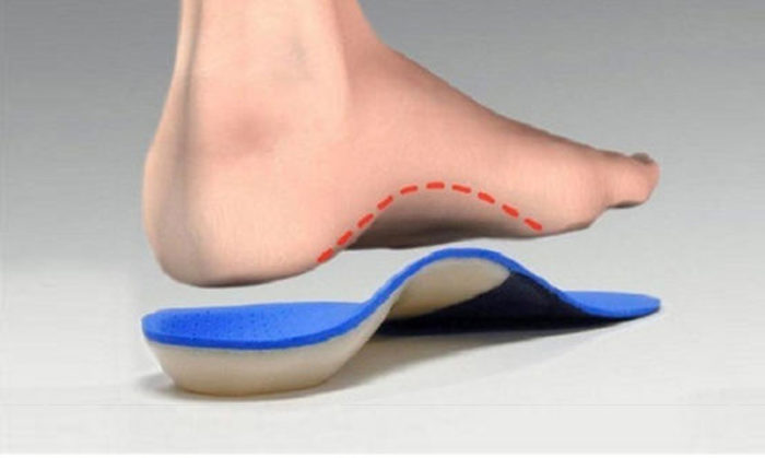 Arch support for foot pain